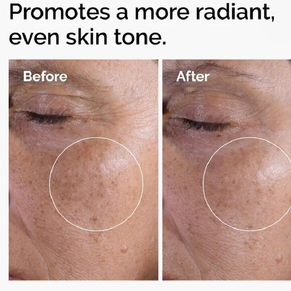 NIB Sealed New Glycolic Acid 7% Toning Solution 8 oz - Picture 4 of 8